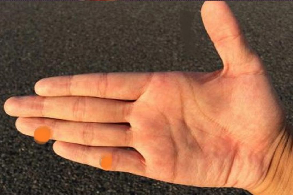 Thumb Palmistry