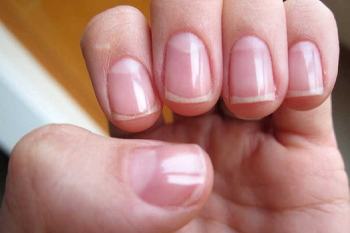 Nails Palmistry: अगर आप की उंगली के नाखून पर है इस तरह का धब्बा तो आप हैं Lucky 