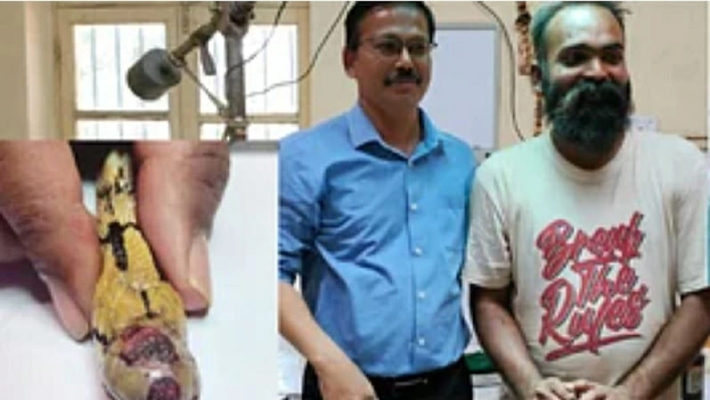 Karnataka: कर्नाटक में हुई सांप की सर्जरी, निकाला गया ट्यूमर, डेढ़ घंटे तक चली सर्जरी