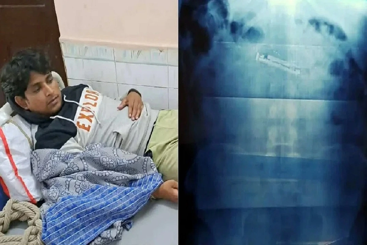 OMG! बिहार में जेल चेकिंग के दौरान मोबाइल निगल गया कैदी, भयंकर दर्द हुआ तो पहुंचा अस्पताल, जानें पूरा मामला