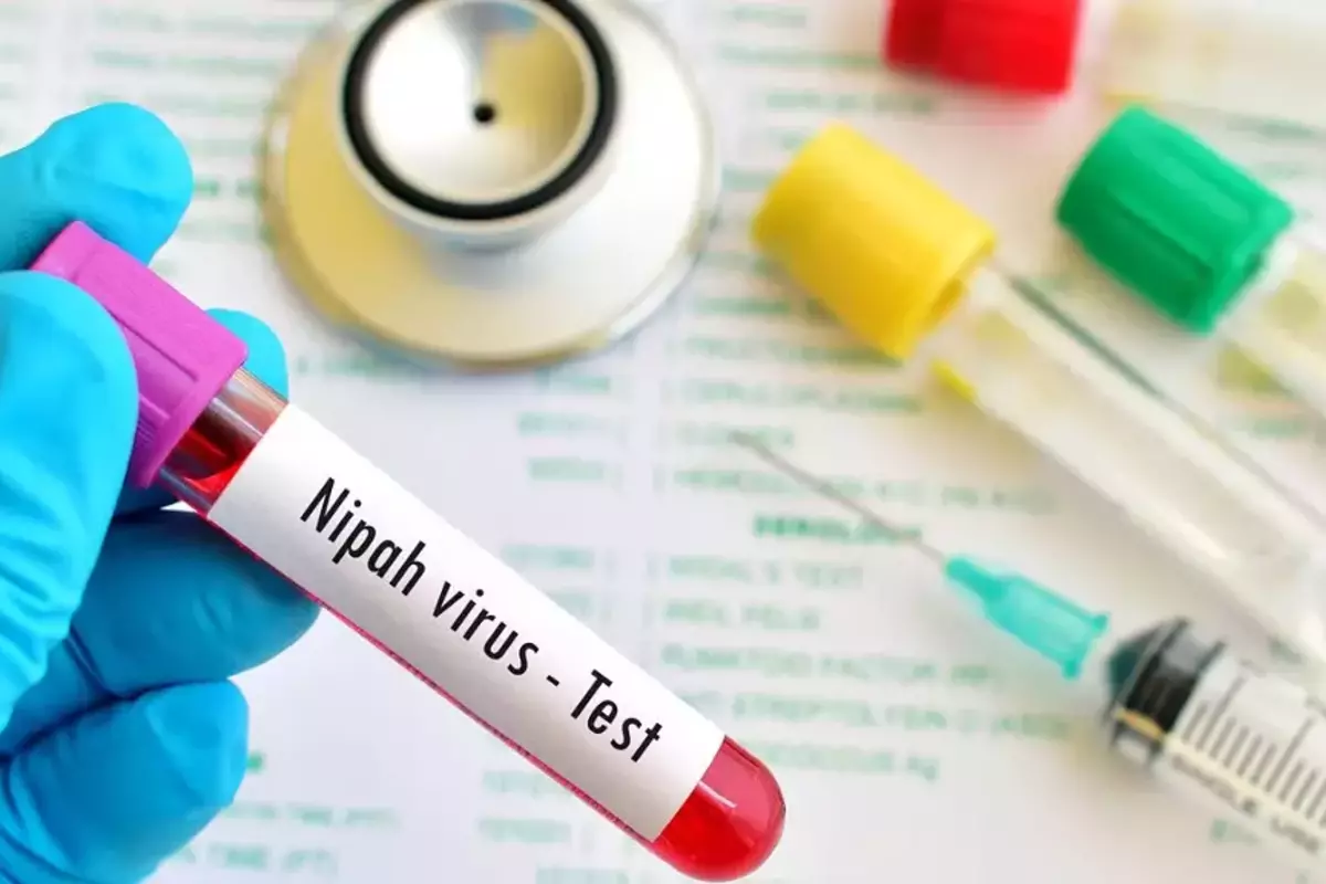 Nipah Virus: निपाह वायरस से दो लोगों की मौत, अलर्ट मोड में सरकार, जानिए इसके लक्षण और बचाव