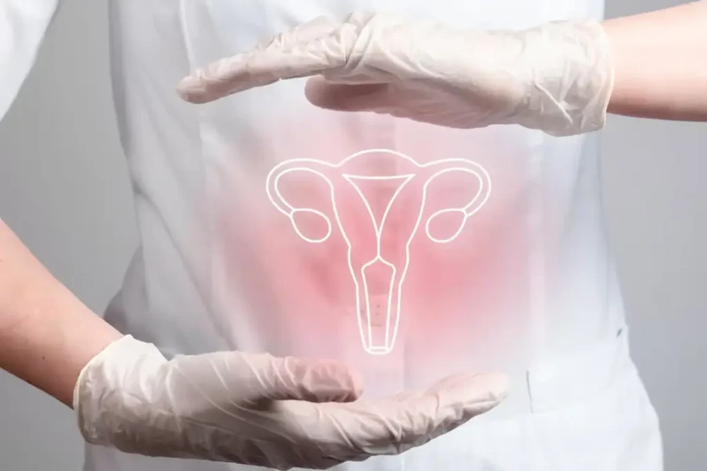Cervical Cancer
