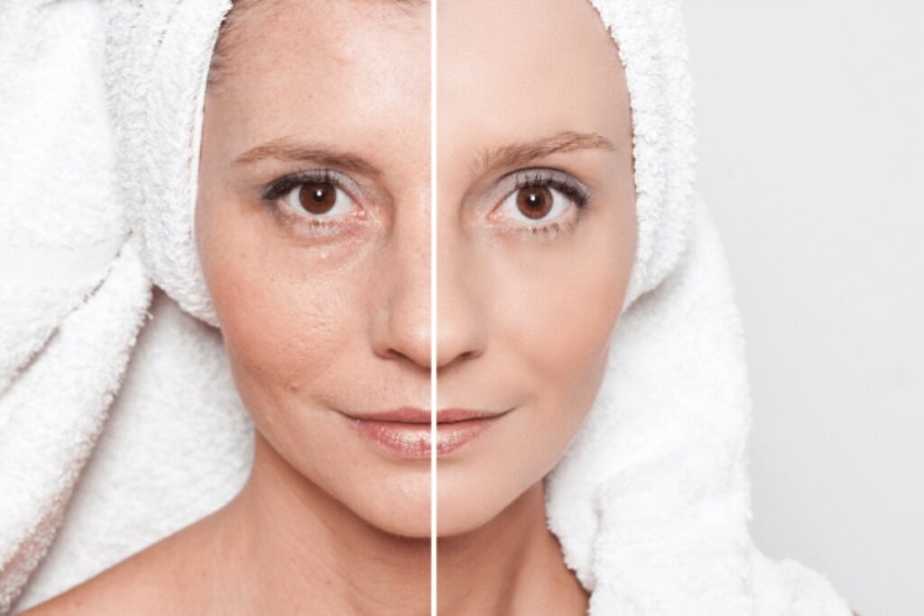Skin Tighten Tips