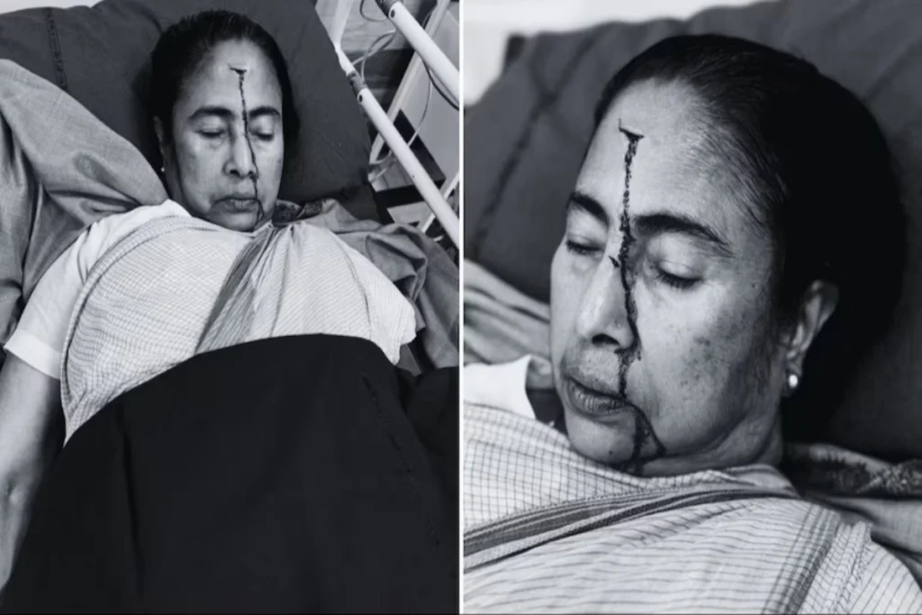 CM Mamata Banerjee suffered serious head injury