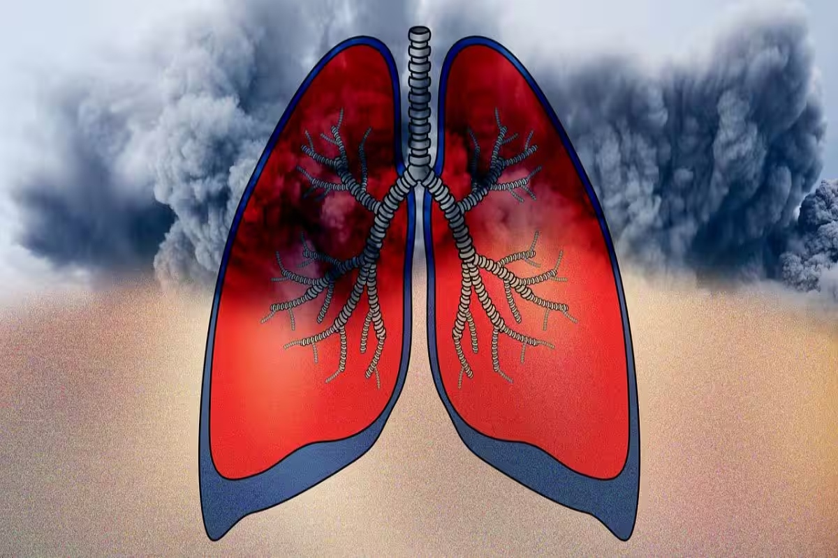 Air Pollution Effects On Lung Health