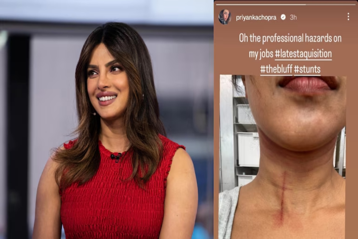 Priyanka Chopra injures