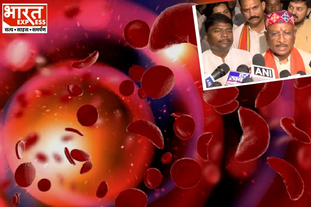 Sickle Cell Disease