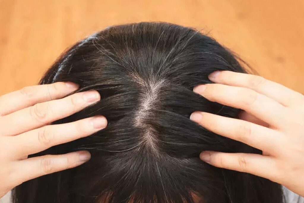 White Hair Solution