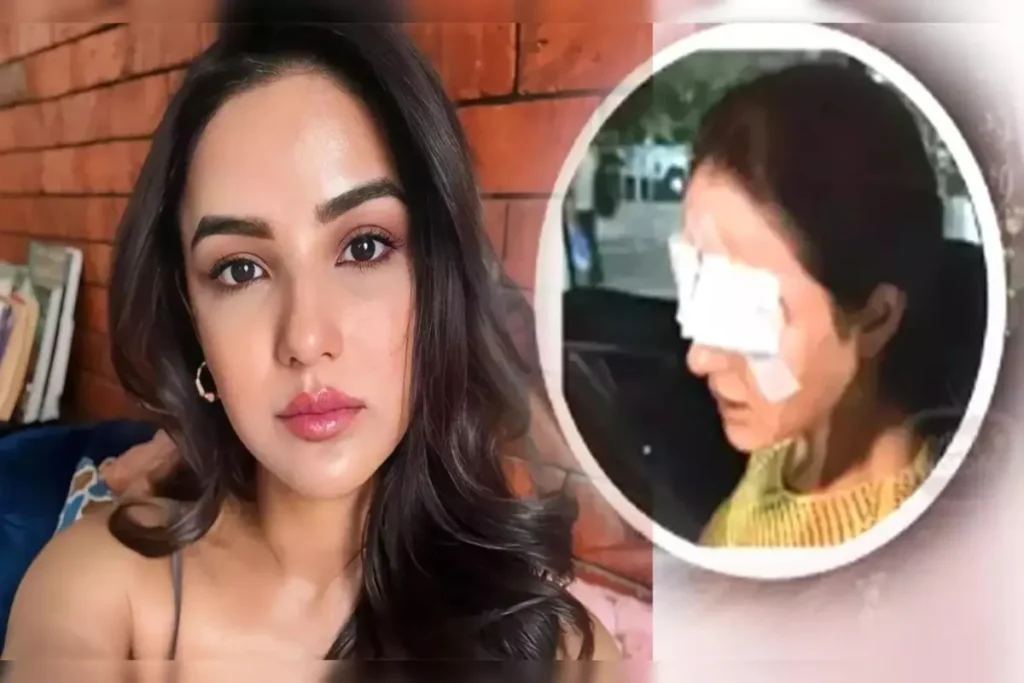 Jasmin Bhasin Blind