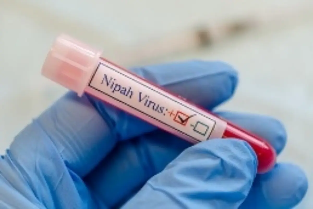 Nipah Virus