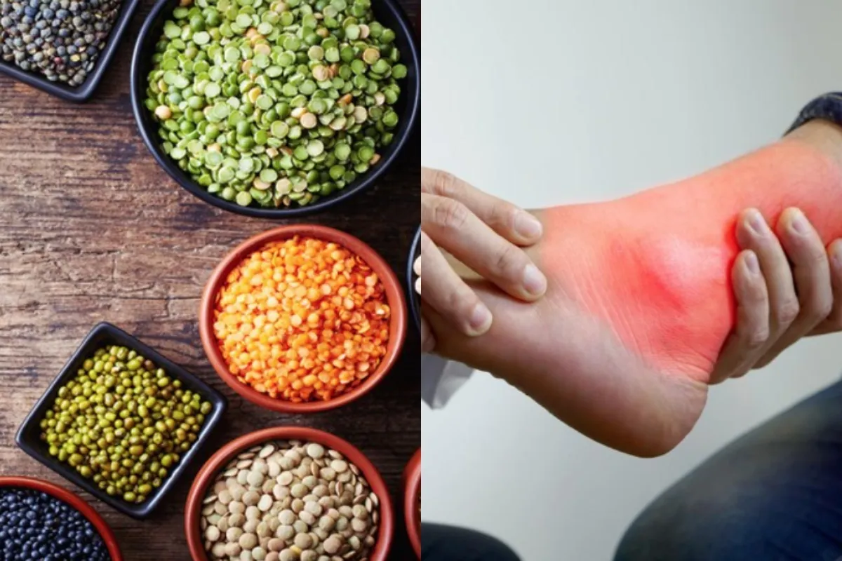 Which Dal is Good for Uric Acid