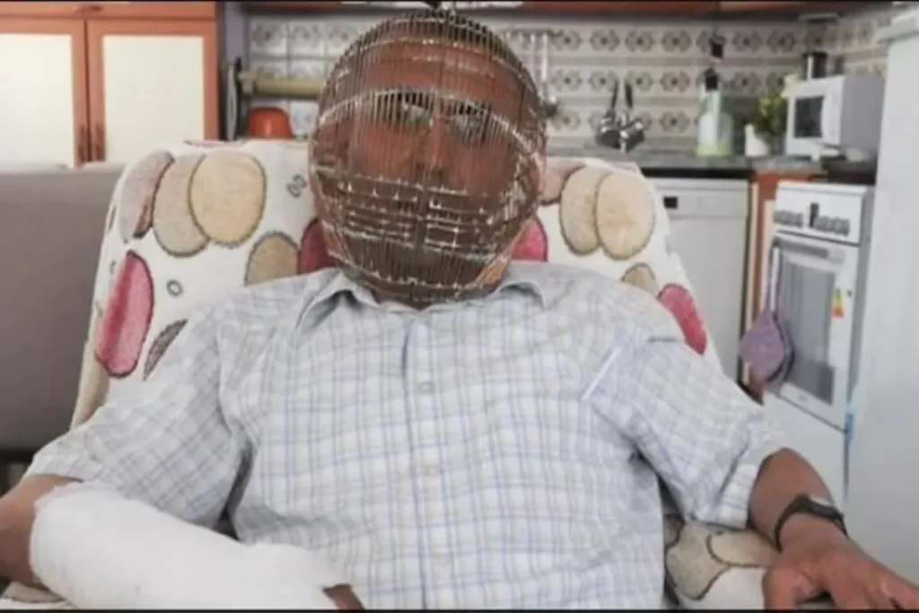 Man Locked His Head In Cage