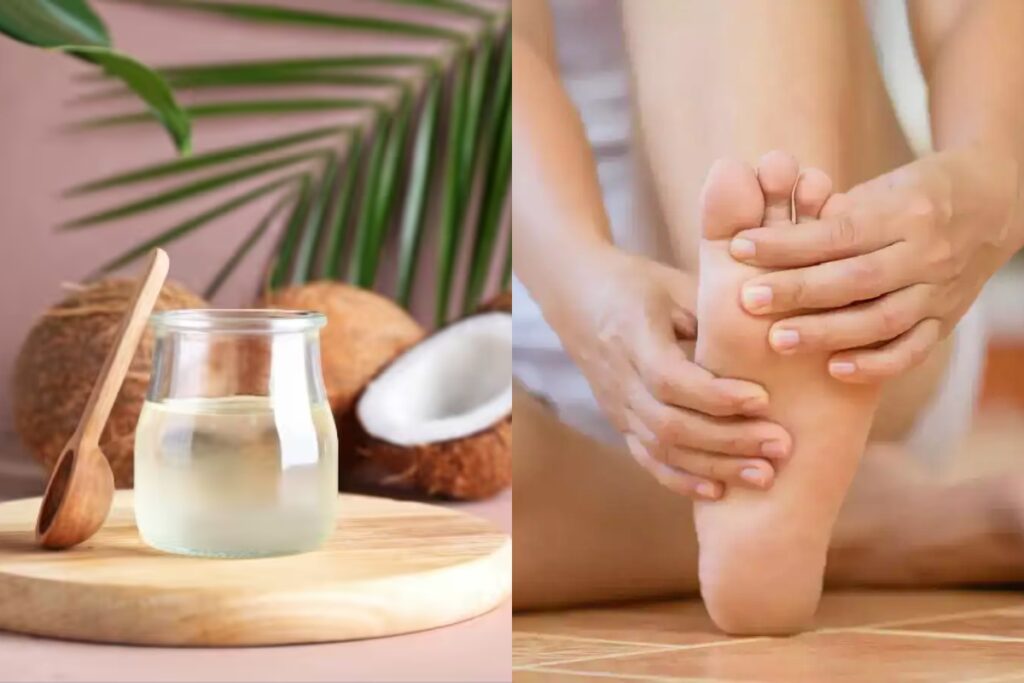 Cracked heels