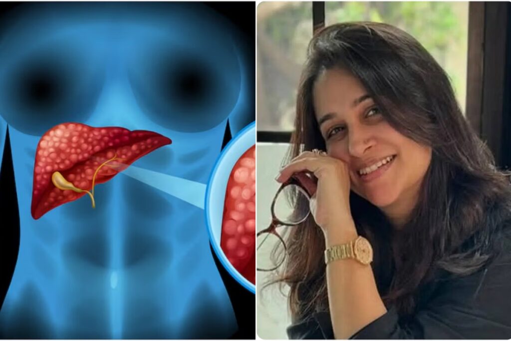 Deepika Kakkar liver tumor