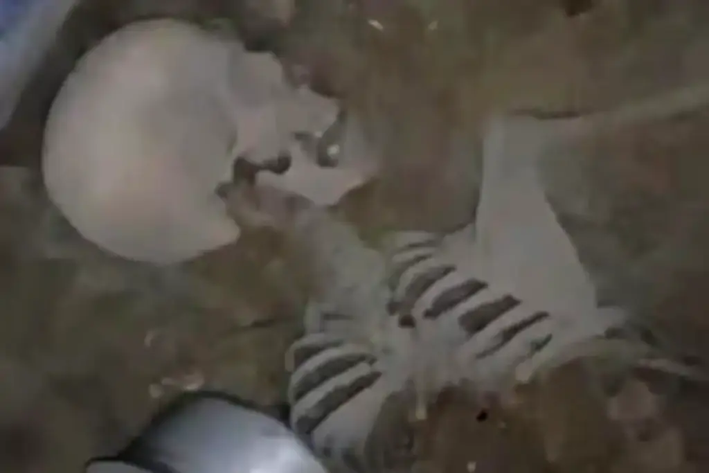 Telangana News Hyderabad skeleton Case
