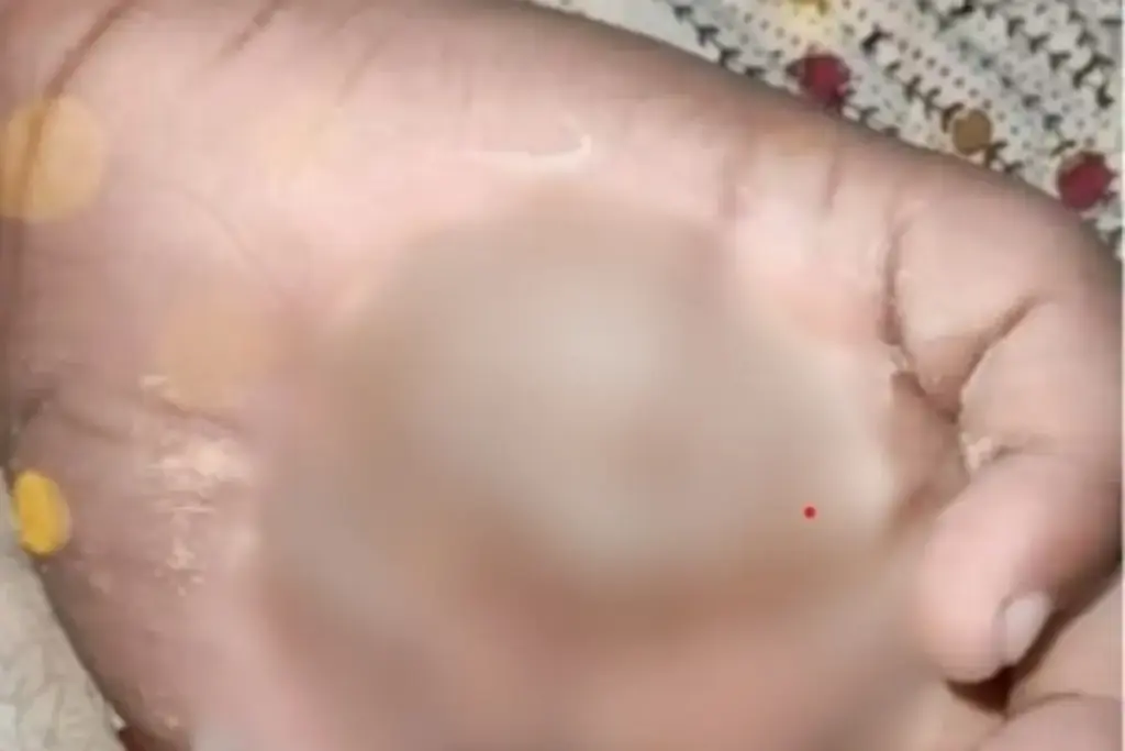 मुंबई के मलाड में दिल दहला देने वाली घटना, खराब लिखावट पर भड़की टीचर ने जलती मोमबत्ती पर रख दी बच्चे की हाथ - भारत एक्सप्रेस