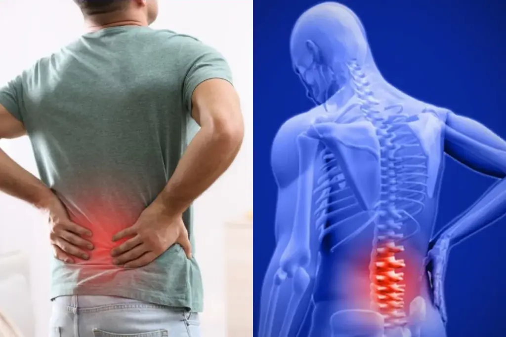 back pain remedies