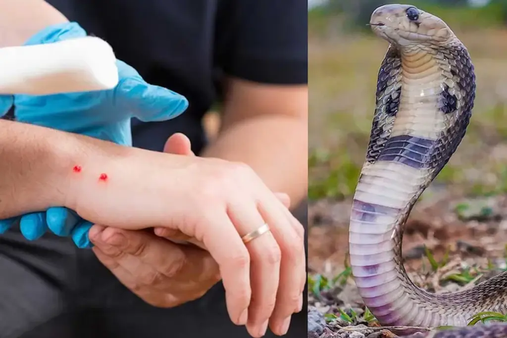 madhya pradesh snakebite