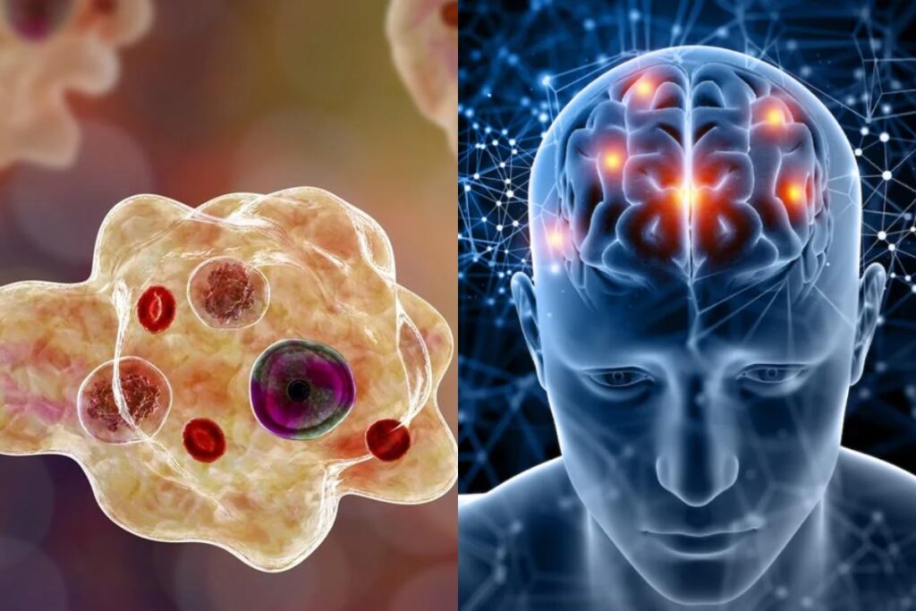 Brain Eating Amoeba