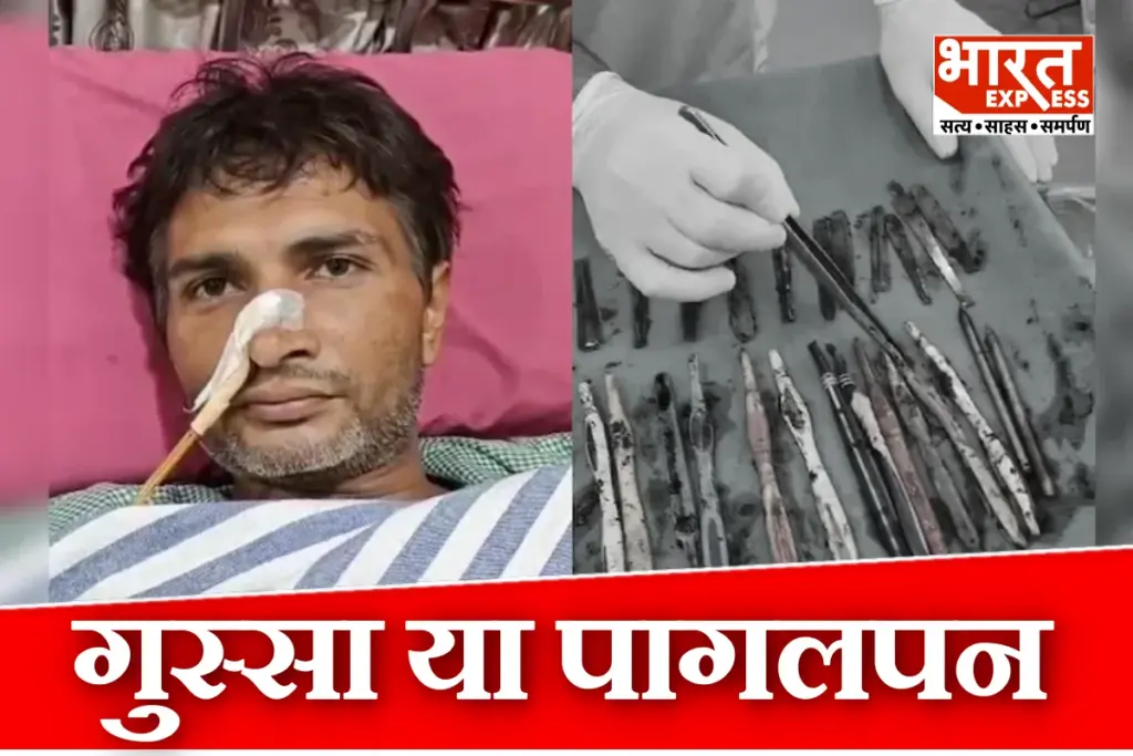 Spoons Toothbrushes found In stomach Of Ghaziabad Man