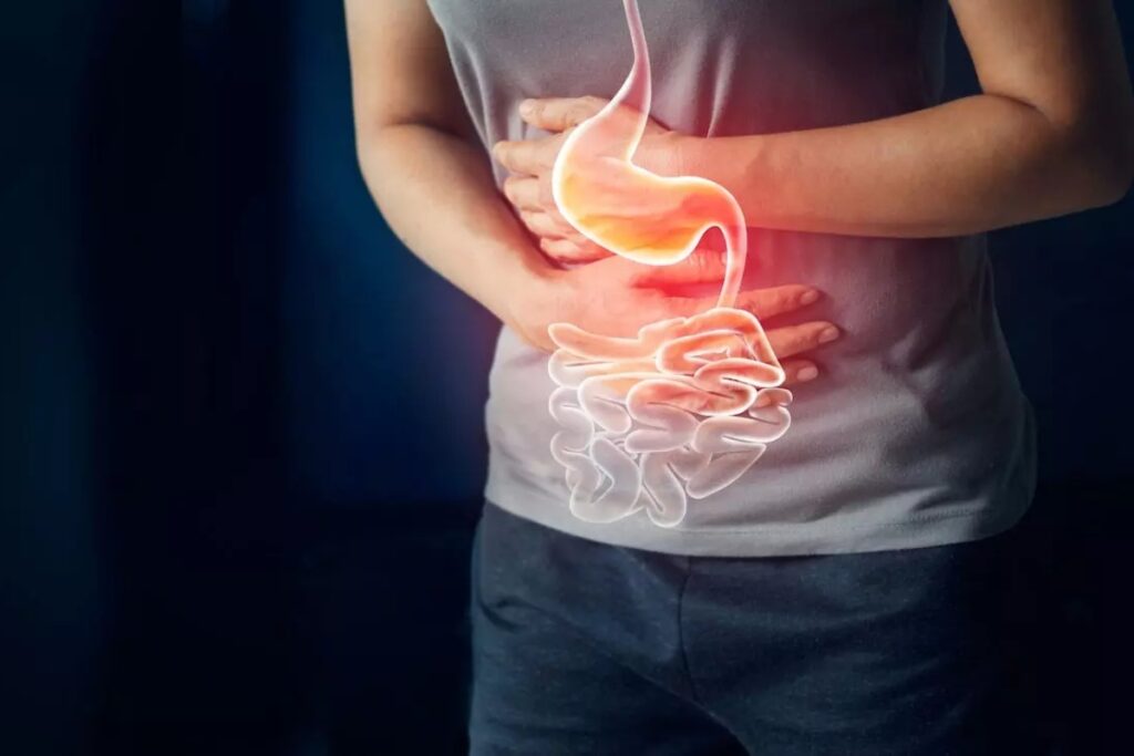 Acidity Home Remedies