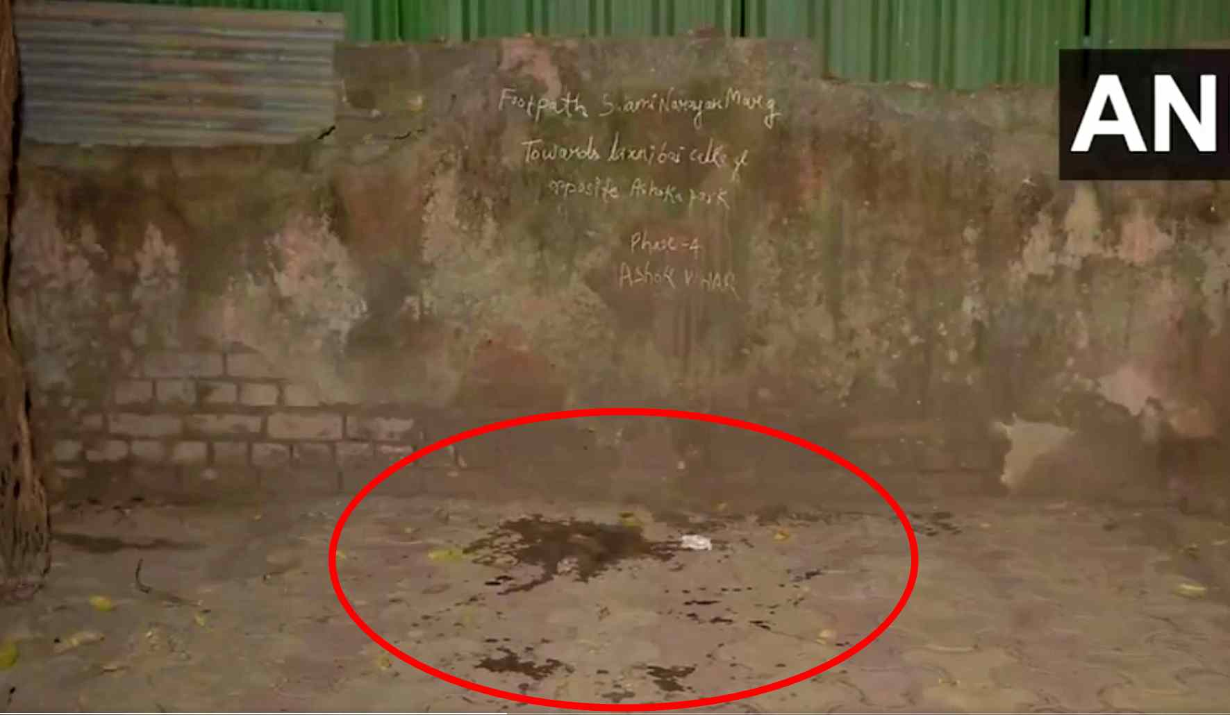 Delhi University Student Acid Attack