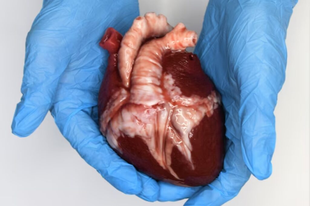 Heart Cancer Research