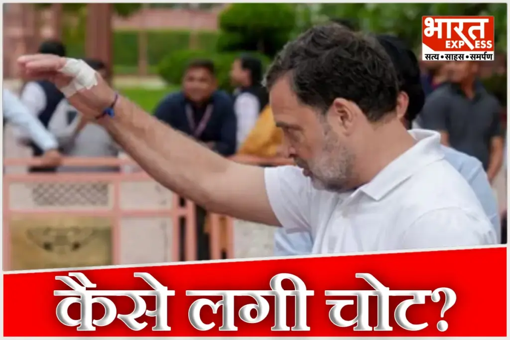 Rahul Gandhi Hand Injury