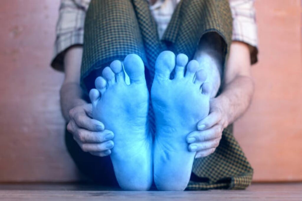 Raynaud's disease symptoms