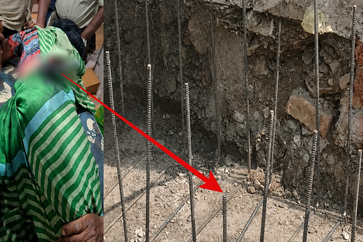 उज्जैन में बड़ा हादसा: नाली निर्माण में लापरवाही से महिला के पेट में घुसा सरिया, 2 घंटे चली सर्जरी