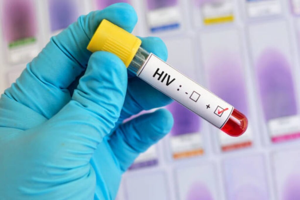 HIV Positive