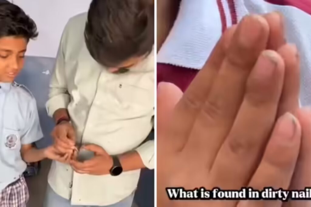 Why should we cut nails