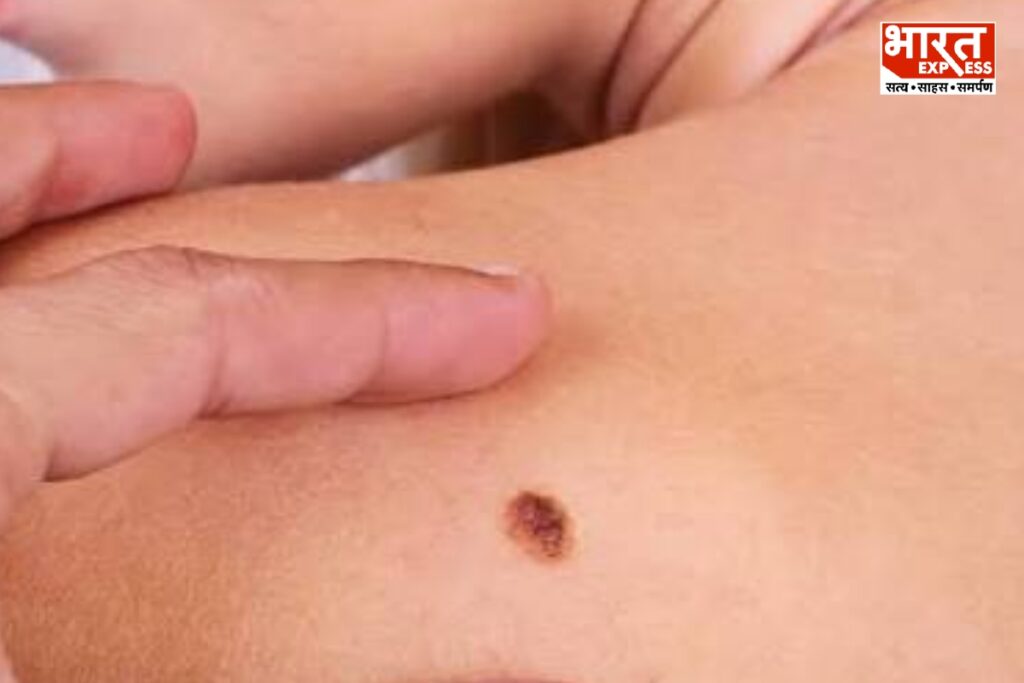 Early Cancer Risk