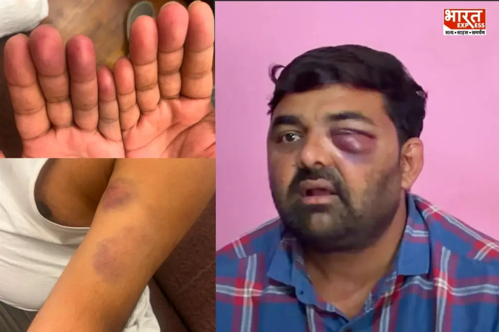 Meerut Police Custody Case Digvijay Bhati Mohit Jatav