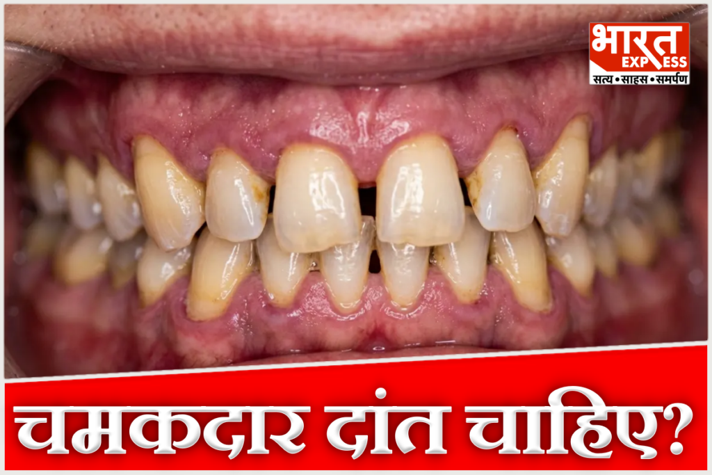 Teeth Whitening Tips