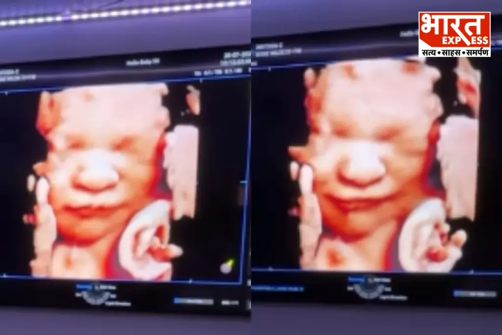Viral Video Unborn Baby Smiles In Ultrasound After Fathers Voice