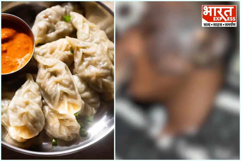 Gwalior Hot Oil Thrown On Student Over 20 Rupee Momos Dispute