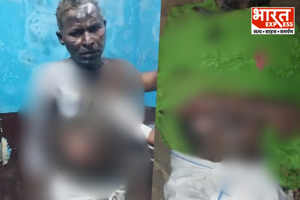 Lakhimpur Kheri Son Sets Parents On Fire In Land Dispute Nighasan