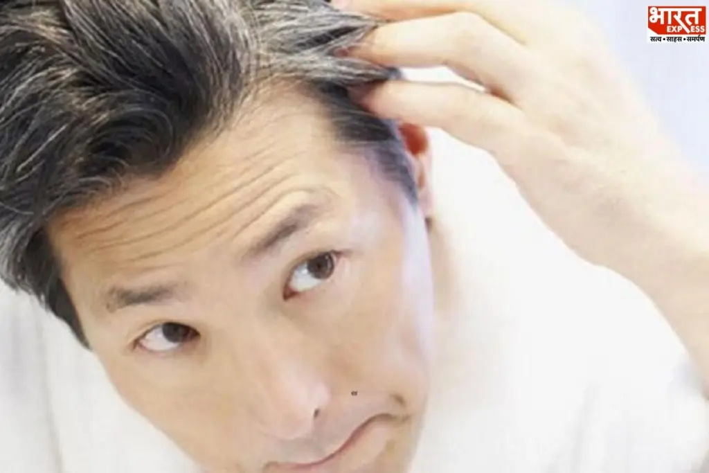Premature Grey Hair Causes